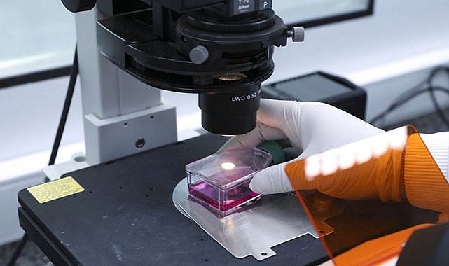 Maymun çiçeği virüsü vakalarına karantina kararı