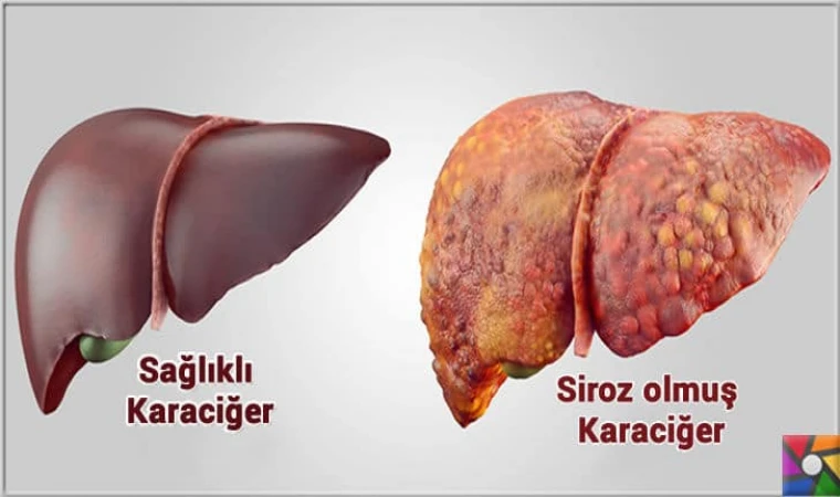 Karaciğer adeta ilk haline dönüyor! Bu besinleri tüketen doktor yüzü görmüyor