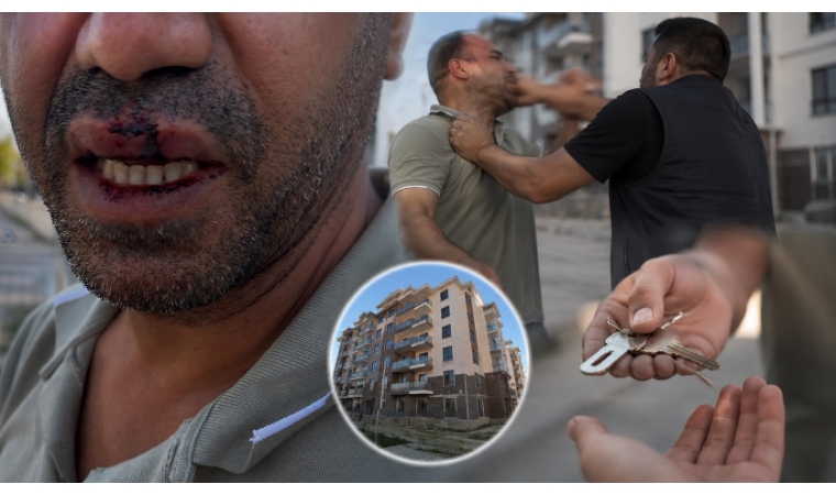 Anahtar Tesliminde Para Talebine İtiraz Eden Vatandaş Hastanelik Oldu