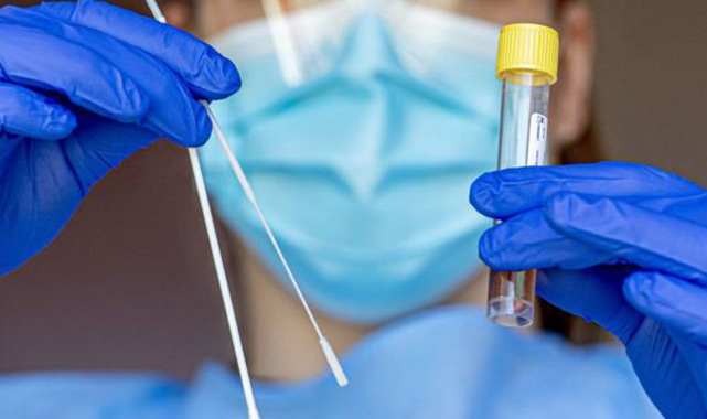 PCR testi ile ilgili detaylar