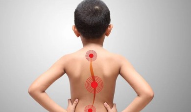 Skolyozda Erken Tanı Çocukların Geleceğini Koruyor